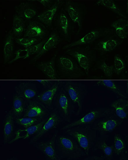 Anti-Bak Antibody (CAB13281)