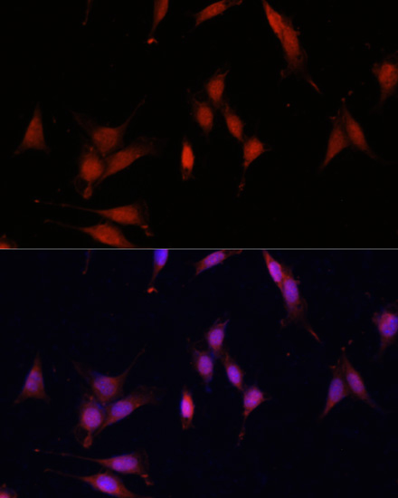 Anti-TET3 Antibody (CAB7612)