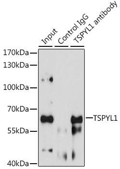 Anti-TSPYL1 Antibody (CAB12174)