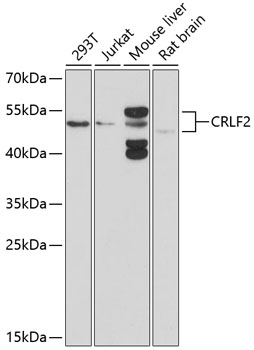 Anti-CRLF2 Antibody (CAB10152)