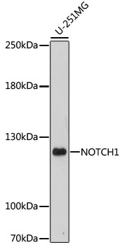 Anti-NOTCH1 Antibody (CAB16673)