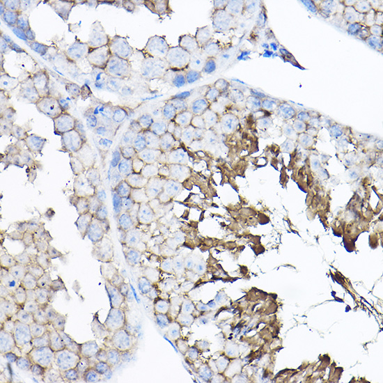 Anti-GNB2 Polyclonal Antibody (CAB8422)