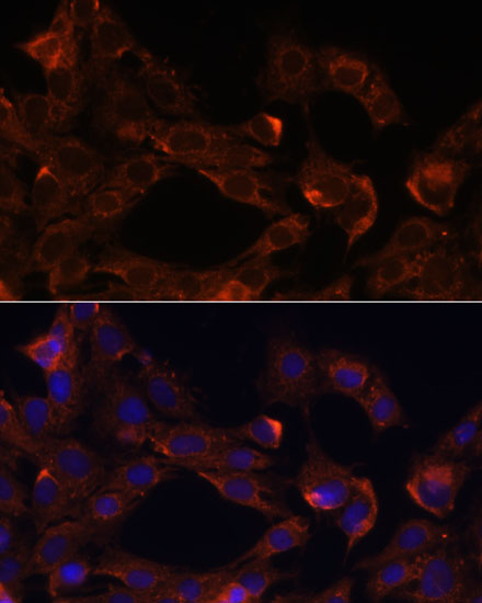 Anti-NRP1 Antibody (CAB16697)