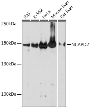 Anti-NCAPD2 Antibody (CAB18412)