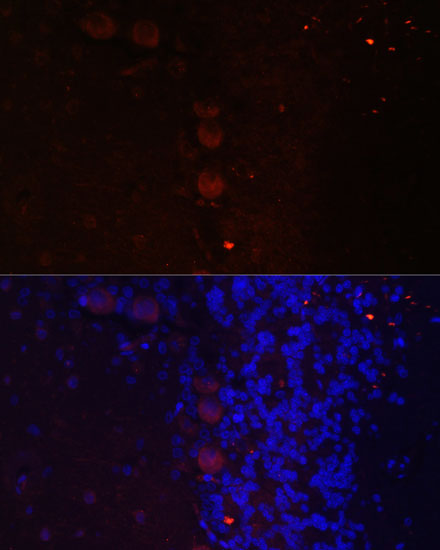 Anti-NEFM Antibody (CAB16405)