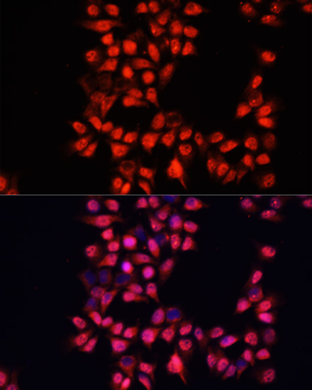 Anti-ADAM10 Antibody (CAB10438)