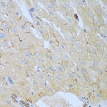 Anti-CEACAM7 Polyclonal Antibody (CAB8112)