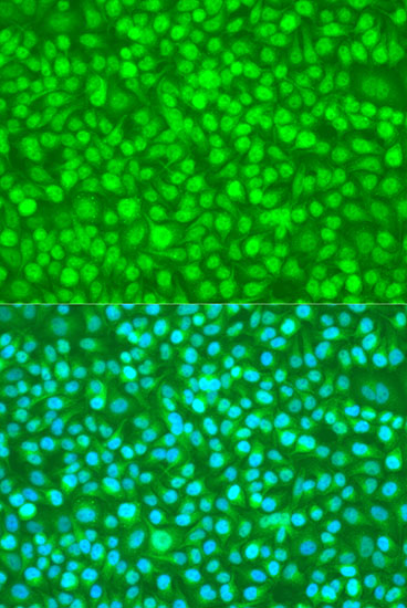 Anti-N4BP1 Polyclonal Antibody (CAB8474)