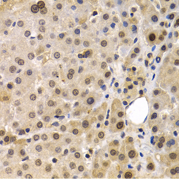 Anti-MAGEA1 Antibody (CAB5470)