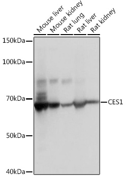 Anti-CES1 Antibody