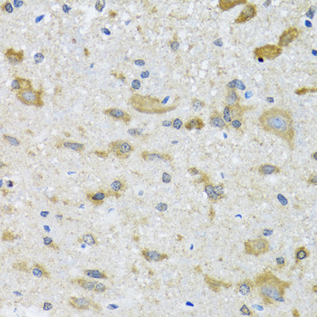 Anti-CCT4 Antibody (CAB6548)