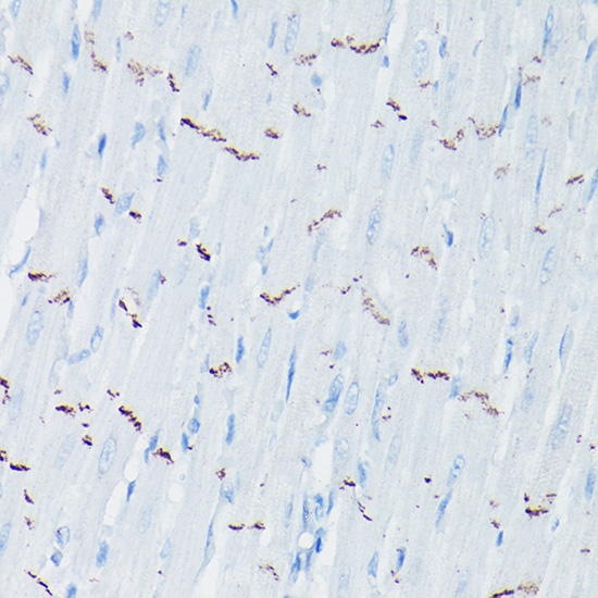 Anti-N-Cadherin Antibody [KO Validated] (CAB0432)