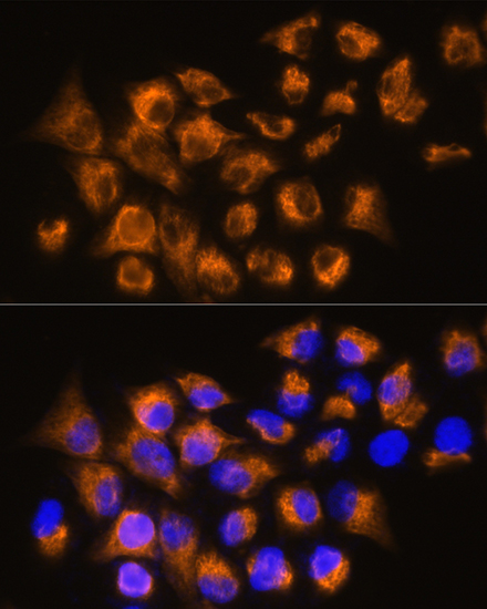 Anti-ADRB3 Polyclonal Antibody (CAB8607)