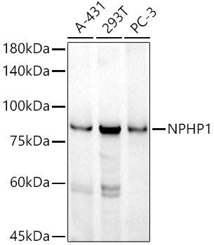 Western blot analysis of extracts of various cell lines, using NPHP1 antibody at 1:1000 dilution. Secondary antibody: HRP Goat Anti-Rabbit IgG (H+L) at 1:10000 dilution. Lysates/proteins: 25ug per lane. Blocking buffer: 3% nonfat dry milk in TBST. Detection: ECL Basic Kit. Exposure time: 180s.