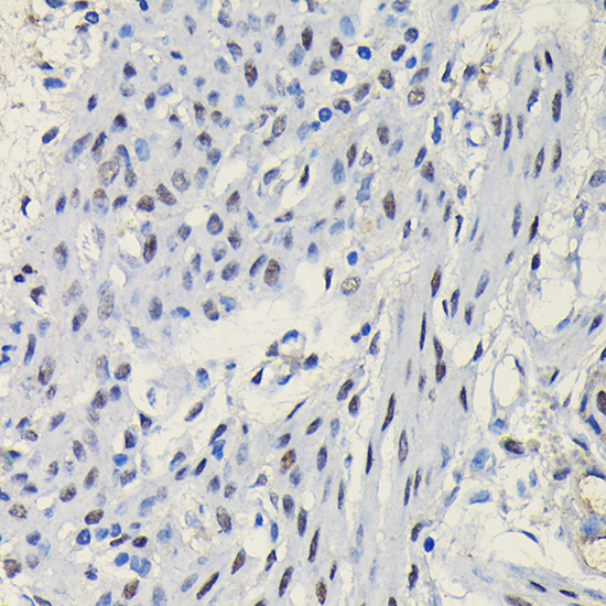 Anti-PGR Antibody (CAB0321)