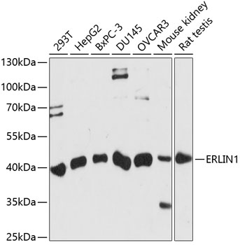 Anti-ERLIN1 Antibody (CAB14843)