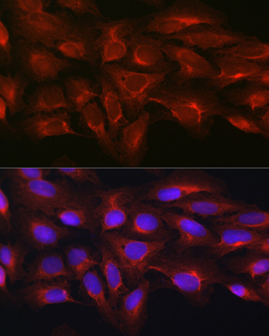 Anti-MLKL Antibody (CAB17312)