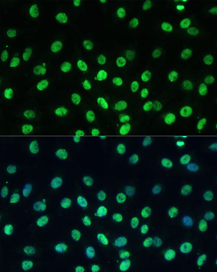 Anti-TRIM28 Antibody (CAB2245)