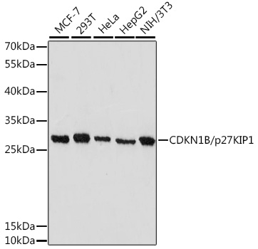 Anti-CDKN1B/p27KIP1 Antibody [KO Validated] (CAB16633)