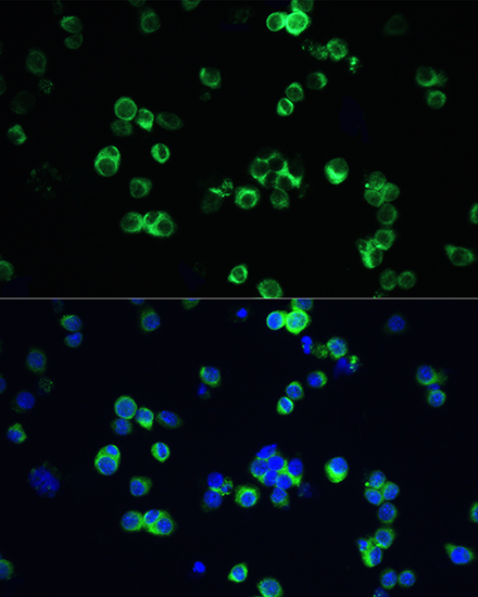 Anti-RIPK3 Antibody (CAB12996)