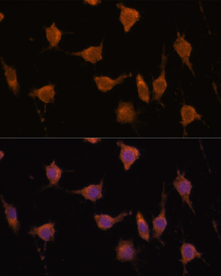 Anti-VAV3 Antibody (CAB15385)