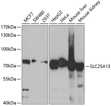 Anti-SLC25A13 Antibody (CAB5849)