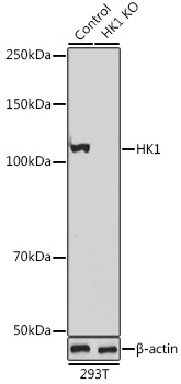 Anti-HK1 Antibody [KO Validated] (CAB1054)