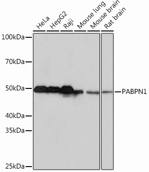 Anti-PABPN1 Rabbit Monoclonal Antibody (CAB1735)