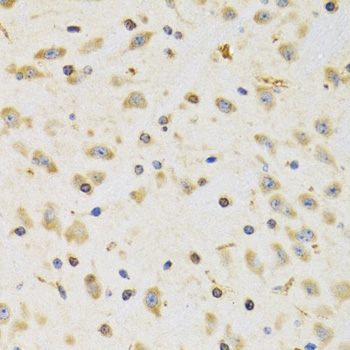 Anti-RPS12 Antibody (CAB5890)