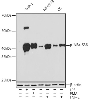 Phospho-IkBAlpha-S36 Rabbit Monoclonal Antibody (CABP0999)