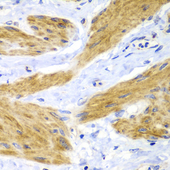 Anti-HRas Antibody (CAB7901)