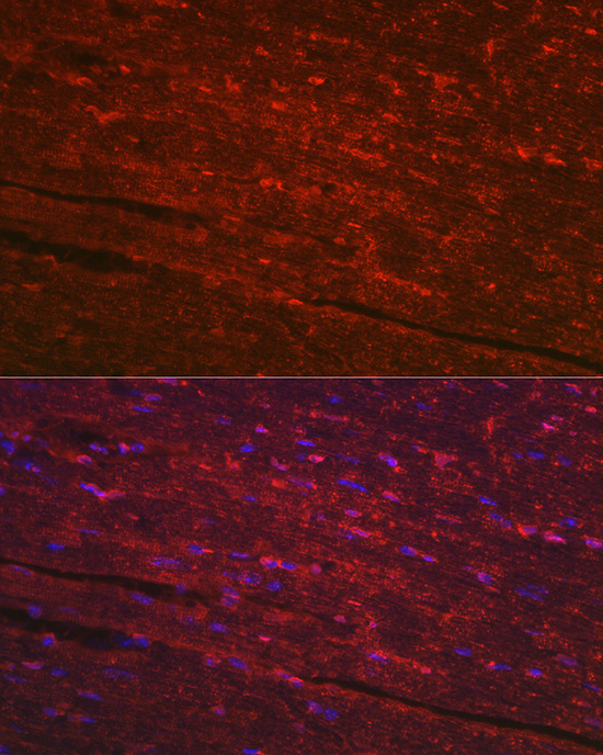 Anti-PGAM2 Antibody (CAB7917)