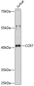 Anti-CCR7 Antibody (CAB14718)