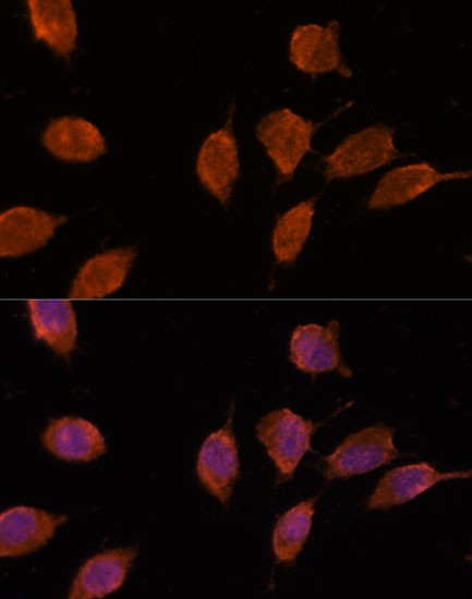 Anti-IPO8 Antibody (CAB14679)