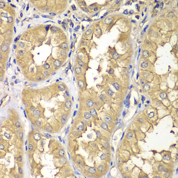 Anti-RAB5C Antibody (CAB7342)