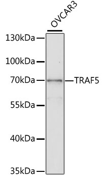 Anti-TRAF5 Antibody (CAB2536)