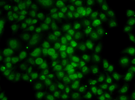 Anti-ATMIN Antibody (CAB7272)