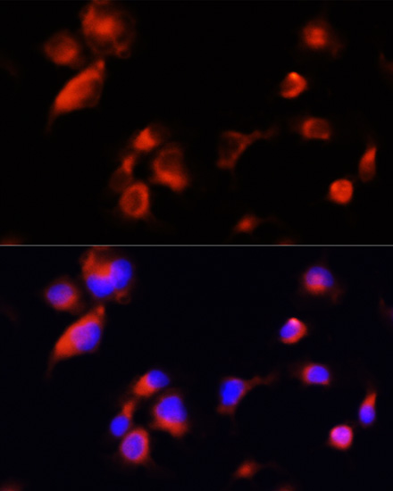 Anti-APOE Antibody (CAB0304)