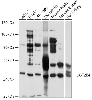 Anti-UGT2B4 Antibody (CAB4180)