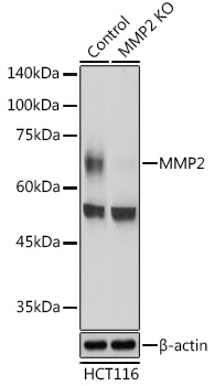 Anti-MMP2 Antibody [KO Validated] (CAB19080)