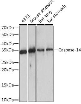 Anti-Caspase-14 Antibody (CAB9618)