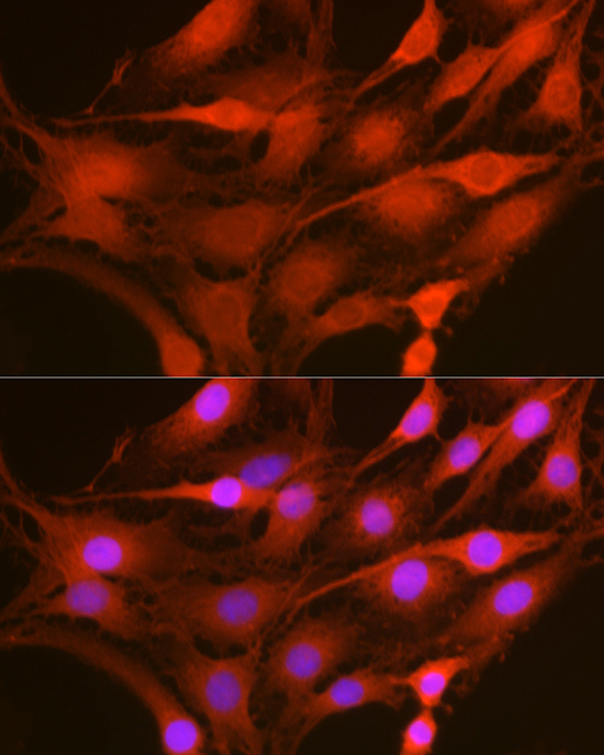 Anti-GAPDH Antibody (CABC001)