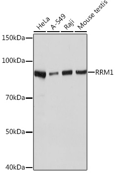 Anti-RRM1 Antibody (CAB4259)