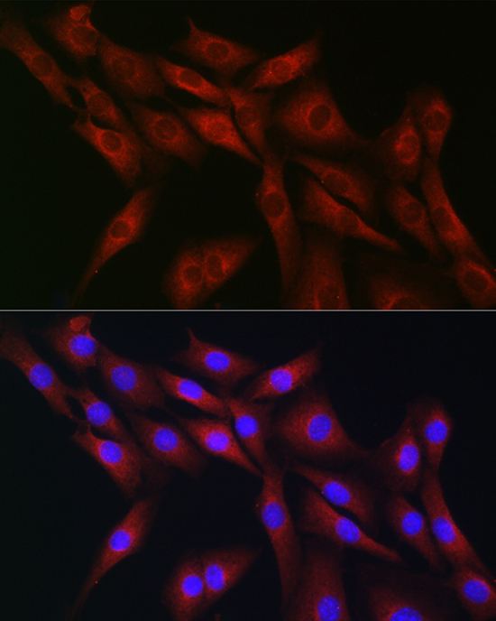 Anti-CDC42 Antibody (CAB1188)