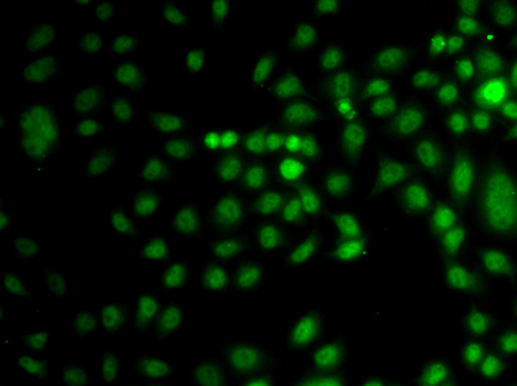 Anti-TRPS1 Antibody (CAB7743)