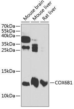 Anti-COX6B1 Antibody (CAB12425)
