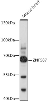 Anti-ZNF587 Antibody (CAB16156)