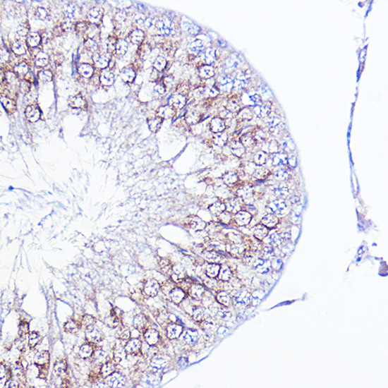 Anti-ITGAV Antibody (CAB2091)