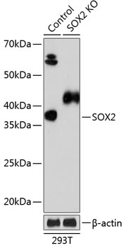 Anti-SOX2 Antibody [KO Validated] (CAB19118)