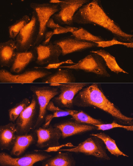 Anti-PFKP Antibody [KO Validated] (CAB7916)